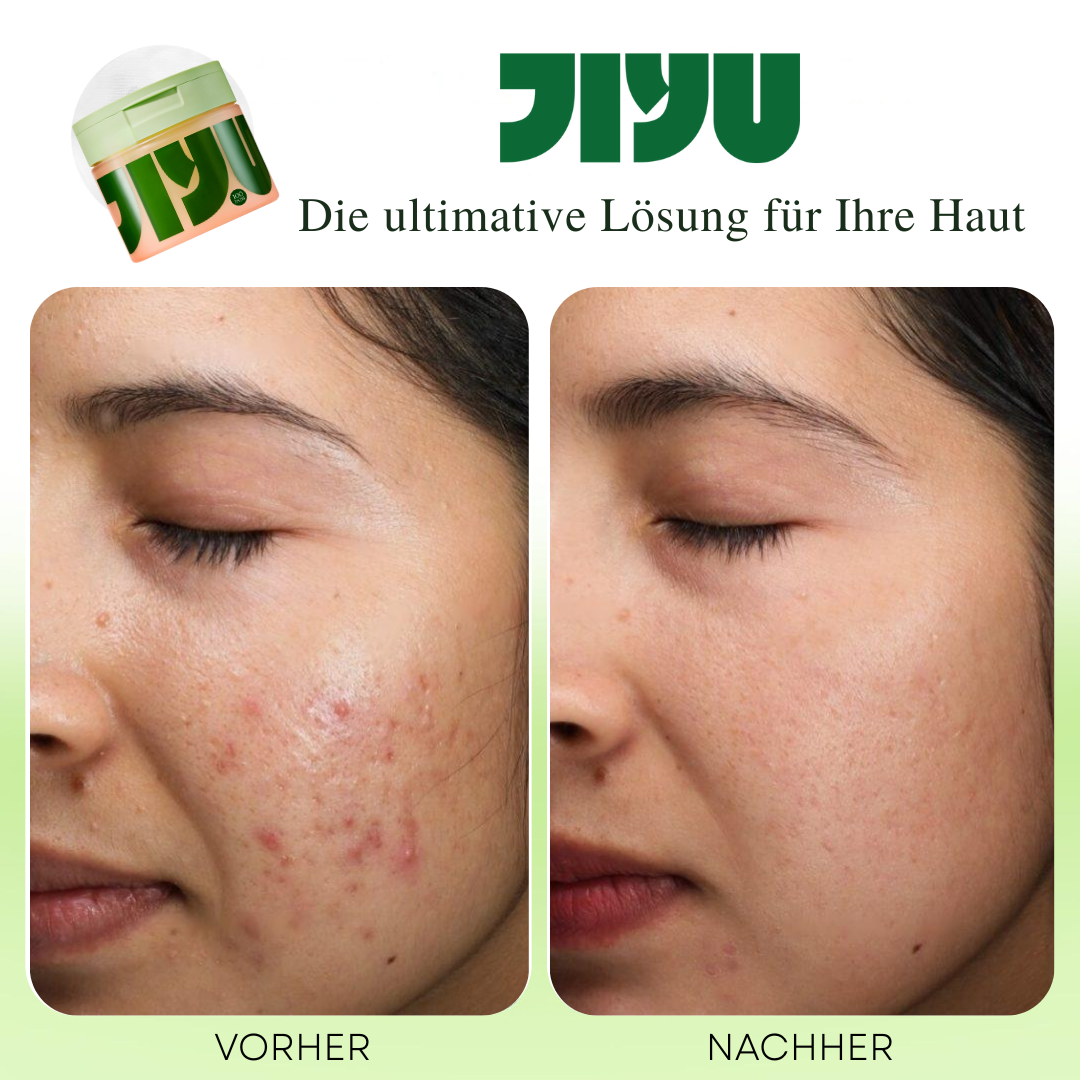 JIYU Tonisierende &amp; Aufhellende Pads